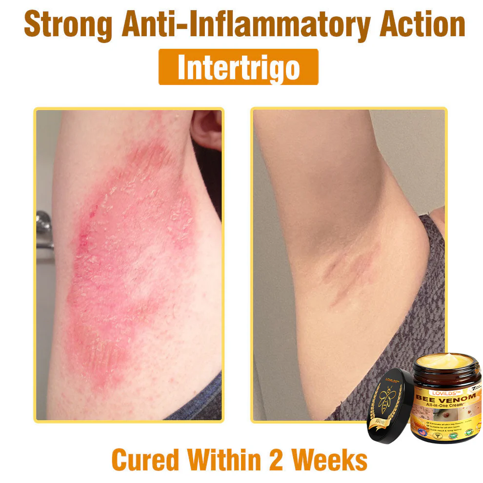 LOVILDS™ Bee Venom All-in-One Cream 14 LOVILDS™ Bee Venom All-in-One Cream