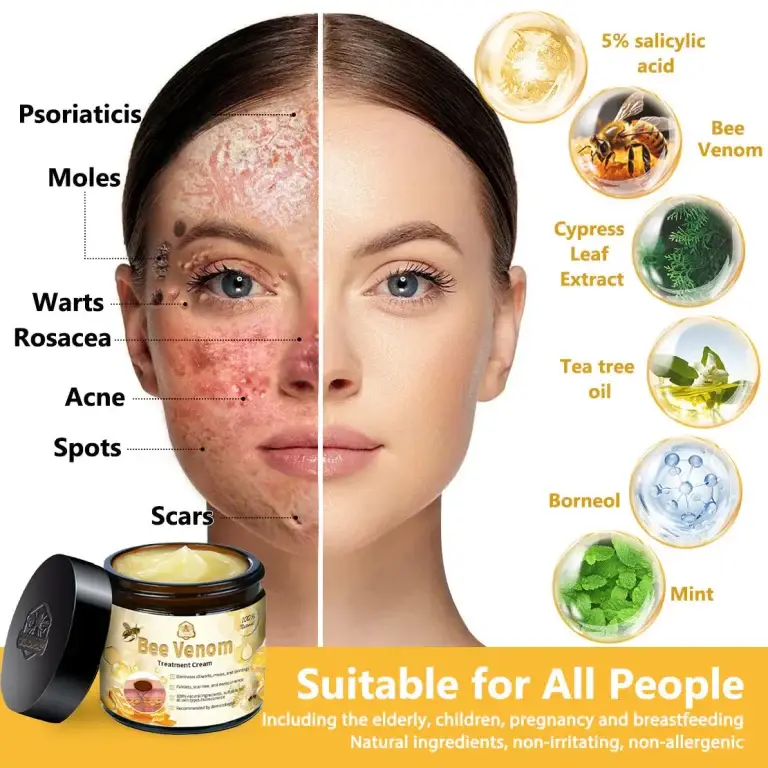 Turonu™ Bee Venom Treatment Cream 11 Turonu™ Bee Venom Treatment Cream