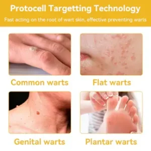 Turonu™ Bee Venom Treatment Cream 20 Turonu™ Bee Venom Treatment Cream