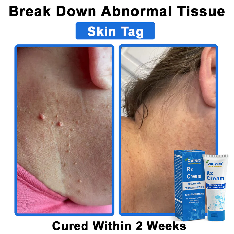 Ourlyard® OatCalm Skin Repair Cream 13 Ourlyard® OatCalm Skin Repair Cream