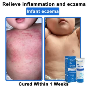 Ourlyard® OatCalm Skin Repair Cream 32 Ourlyard® OatCalm Skin Repair Cream