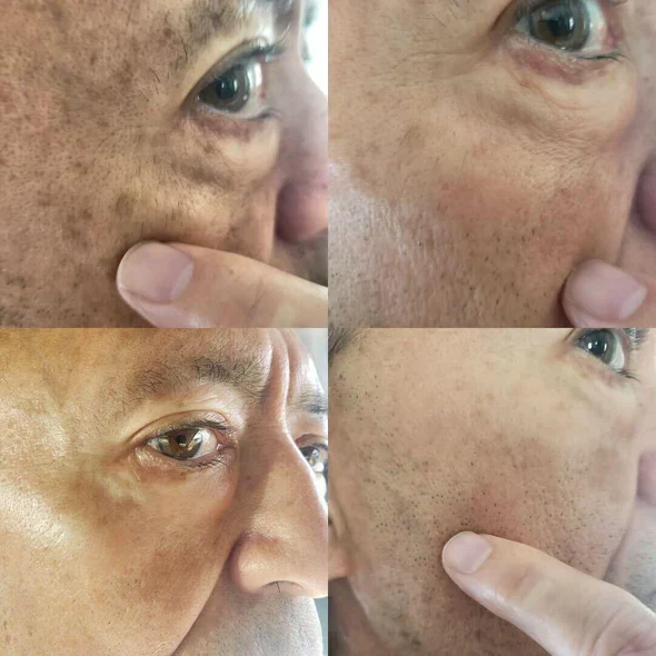 AQA™ Melanin Correcting Facial Serum 13 AQA™ Melanin Correcting Facial Serum