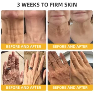 Fivfivgo™ BeeLift Anti-Ageing Firming Cream