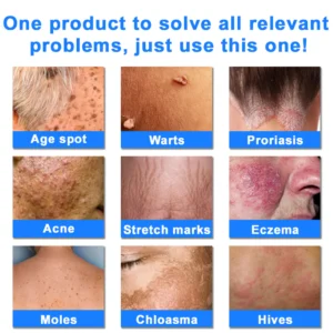 Ourlyard® OatCalm Skin Repair Cream 30 Ourlyard® OatCalm Skin Repair Cream