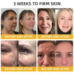 Fivfivgo™ BeeLift Anti-Ageing Firming Cream