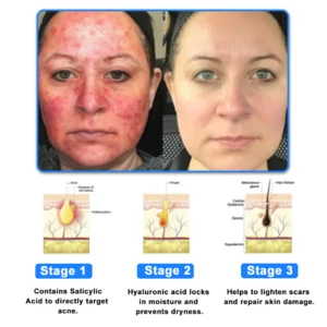 Ourlyard® OatCalm Skin Repair Cream 28 Ourlyard® OatCalm Skin Repair Cream