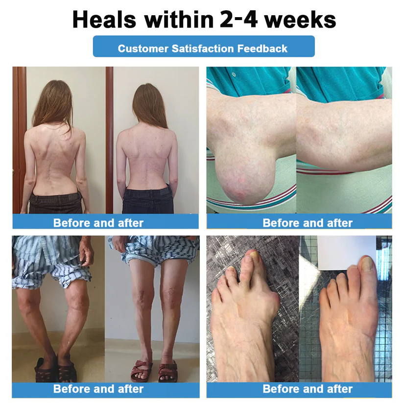 Thonesr® Nano-microneedle joint patch 13 Thonesr® Nano-microneedle joint patch