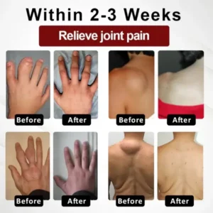 Fivfivgo™ Horse Chestnut Arthritis Massage Cream 23 Fivfivgo™ Horse Chestnut Arthritis Massage Cream