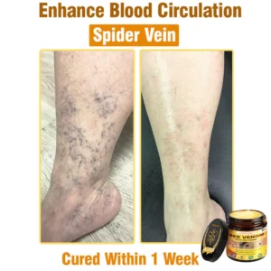 LOVILDS™ Bee Venom All-in-One Cream 25 LOVILDS™ Bee Venom All-in-One Cream