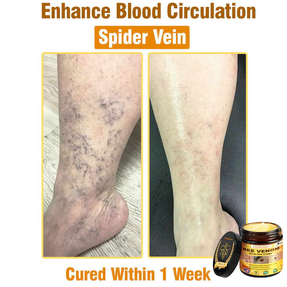 LOVILDS™ Bee Venom All-in-One Cream 12 LOVILDS™ Bee Venom All-in-One Cream