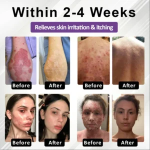 Fivfivgo® Purple Corn Multi-Condition Skin Spray 9 Fivfivgo® Purple Corn Multi-Condition Skin Spray