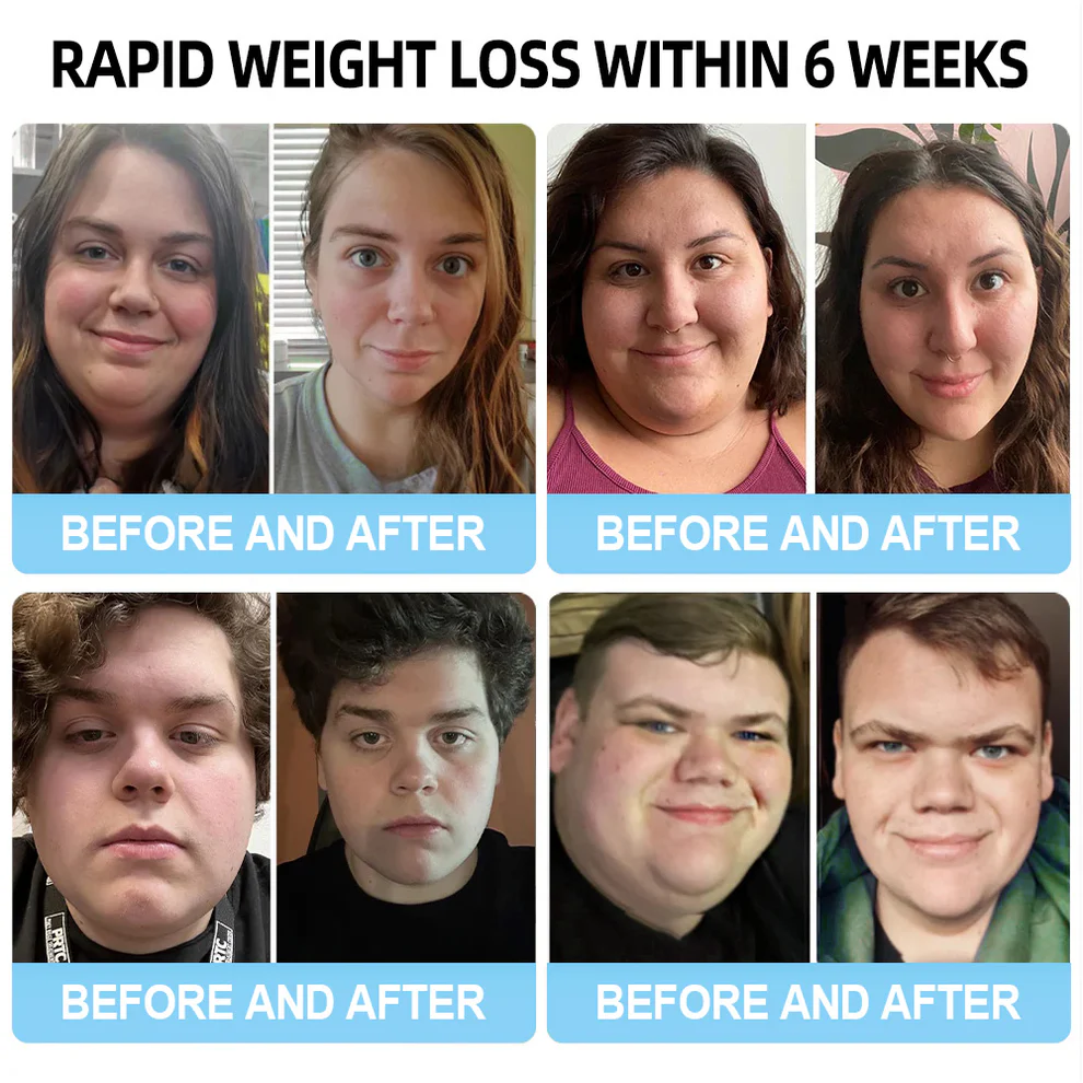 Lmipki® NIDDK-Tirzepatide Nano Microneedle Patch 11 Lmipki® NIDDK-Tirzepatide Nano Microneedle Patch