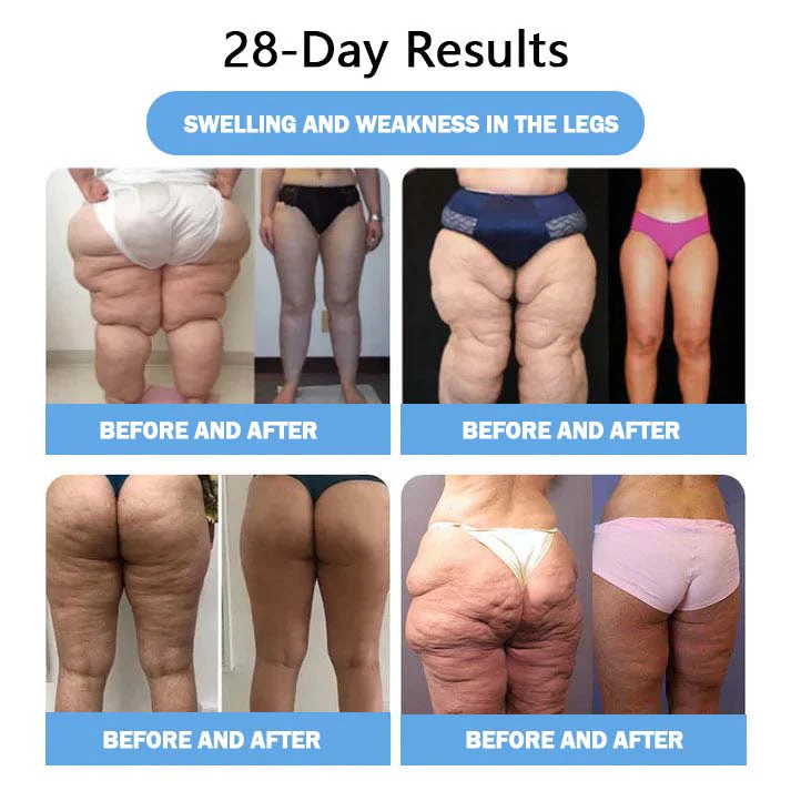 Lmipki® NIDDK-Tirzepatide Nano Microneedle Patch 6 Lmipki® NIDDK-Tirzepatide Nano Microneedle Patch