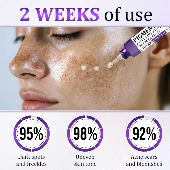 Fivfivgo® PigmentaX ProFade Anti-Hyperpigmentation Cream 5 Fivfivgo® PigmentaX ProFade Anti-Hyperpigmentation Cream