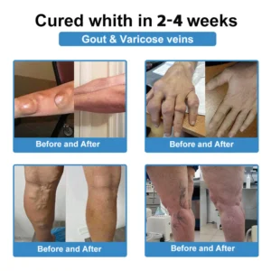 Fivfivgo® Nano-Microneedle Joint Patch 28 Fivfivgo® Nano-Microneedle Joint Patch