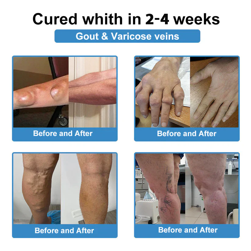 Fivfivgo® Nano-Microneedle Joint Patch 14 Fivfivgo® Nano-Microneedle Joint Patch