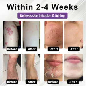 Fivfivgo® Purple Corn Multi-Condition Skin Spray 8 Fivfivgo® Purple Corn Multi-Condition Skin Spray