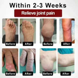 Fivfivgo™ Horse Chestnut Arthritis Massage Cream 22 Fivfivgo™ Horse Chestnut Arthritis Massage Cream