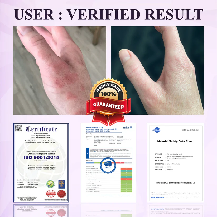 Fivfivgo® Purple Corn Multi-Condition Skin Spray 3 Fivfivgo® Purple Corn Multi-Condition Skin Spray