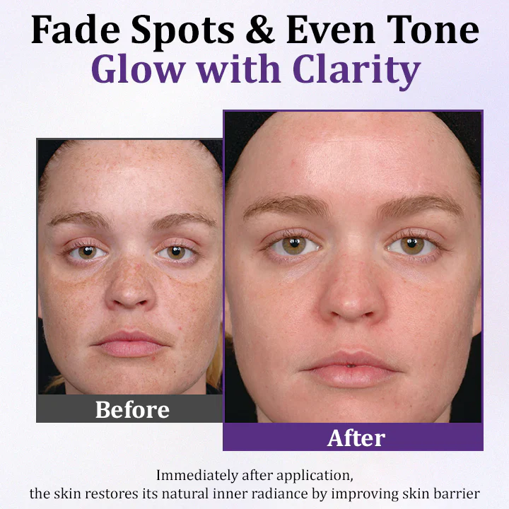 Fivfivgo® PigmentaX ProFade Anti-Hyperpigmentation Cream 4 Fivfivgo® PigmentaX ProFade Anti-Hyperpigmentation Cream