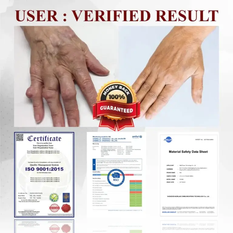 Fivfivgo™ Horse Chestnut Arthritis Massage Cream 10 Fivfivgo™ Horse Chestnut Arthritis Massage Cream