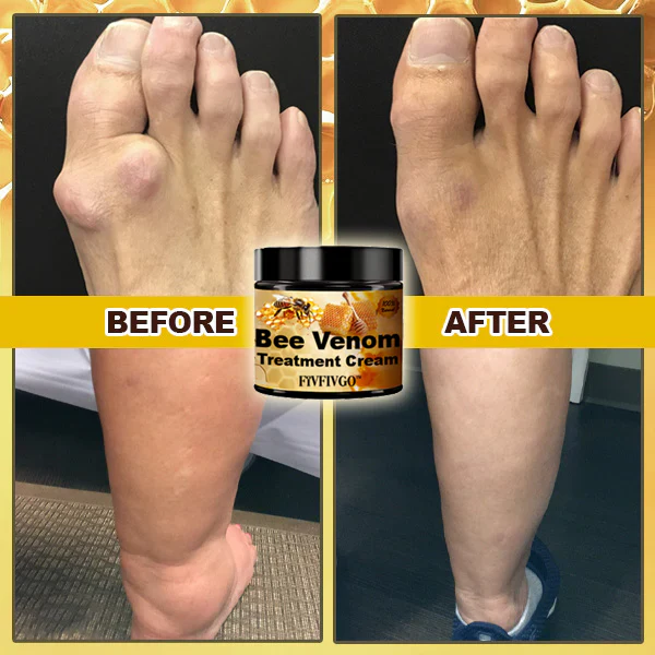 Fivfivgo™ Arthritis Treatment Bee Venom Cream 4 Fivfivgo™ Arthritis Treatment Bee Venom Cream