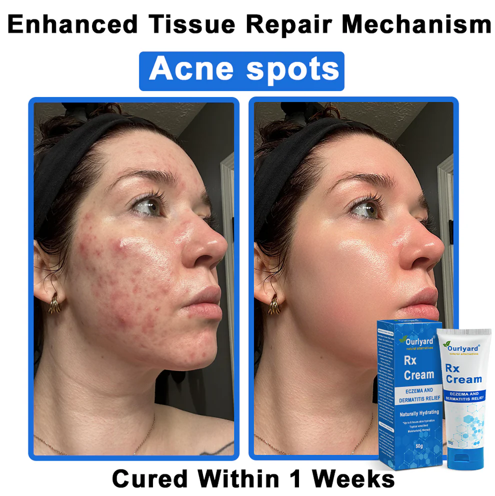 Ourlyard® OatCalm Skin Repair Cream 20 Ourlyard® OatCalm Skin Repair Cream