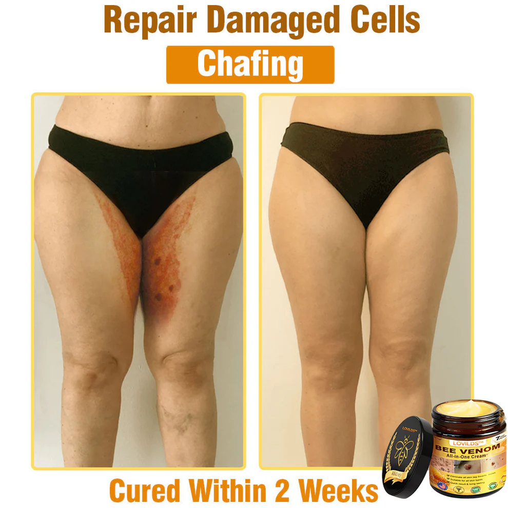 LOVILDS™ Bee Venom All-in-One Cream 9 LOVILDS™ Bee Venom All-in-One Cream