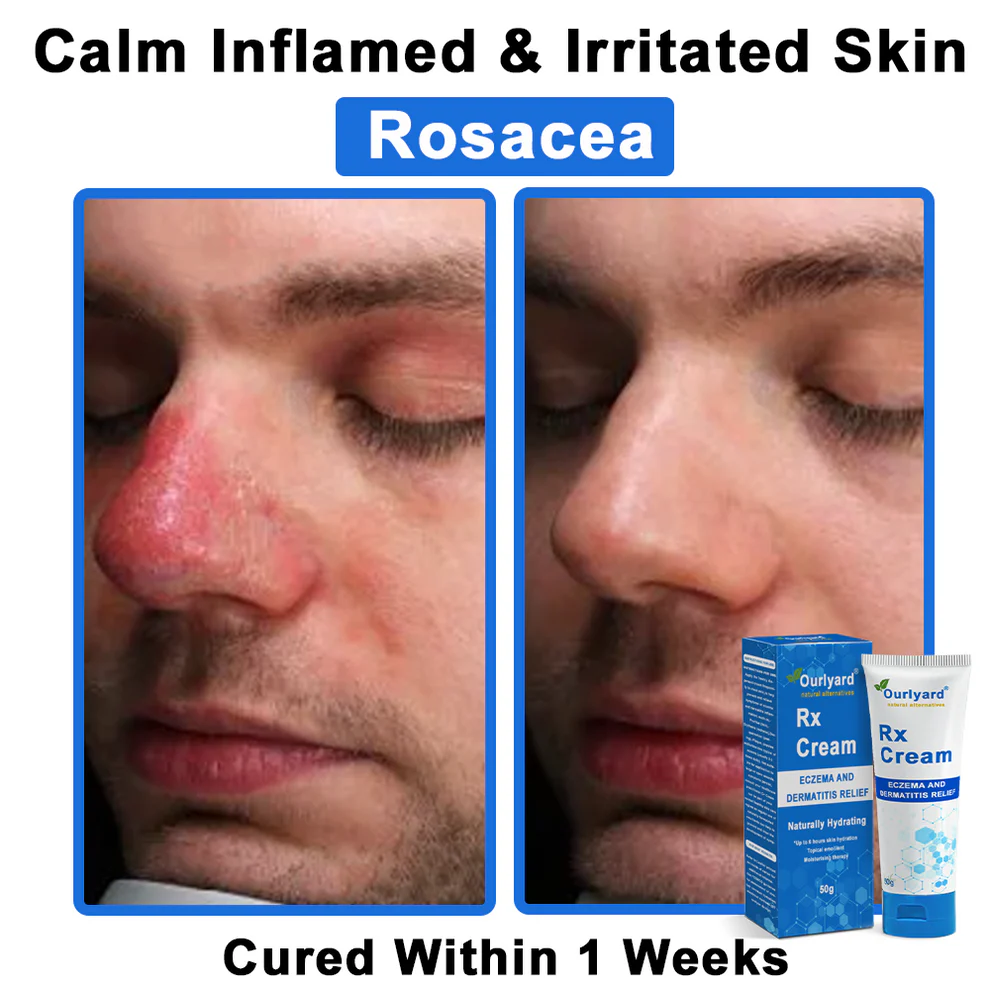 Ourlyard® OatCalm Skin Repair Cream 19 Ourlyard® OatCalm Skin Repair Cream