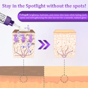 Fivfivgo® PigmentaX ProFade Anti-Hyperpigmentation Cream 8 Fivfivgo® PigmentaX ProFade Anti-Hyperpigmentation Cream