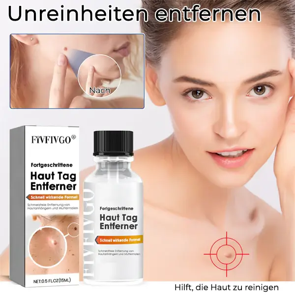 Fivfivgo® Bee Venom Tags & Moles Remover 4 Fivfivgo® Bee Venom Tags & Moles Remover