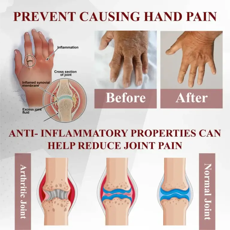 Fivfivgo™ Horse Chestnut Arthritis Massage Cream 7 Fivfivgo™ Horse Chestnut Arthritis Massage Cream