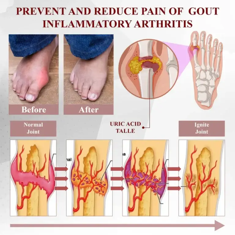 Fivfivgo™ Horse Chestnut Arthritis Massage Cream 5 Fivfivgo™ Horse Chestnut Arthritis Massage Cream