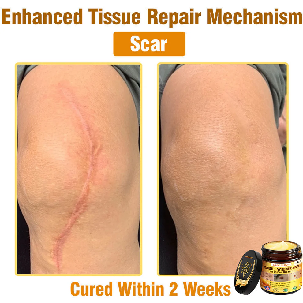 LOVILDS™ Bee Venom All-in-One Cream 6 LOVILDS™ Bee Venom All-in-One Cream