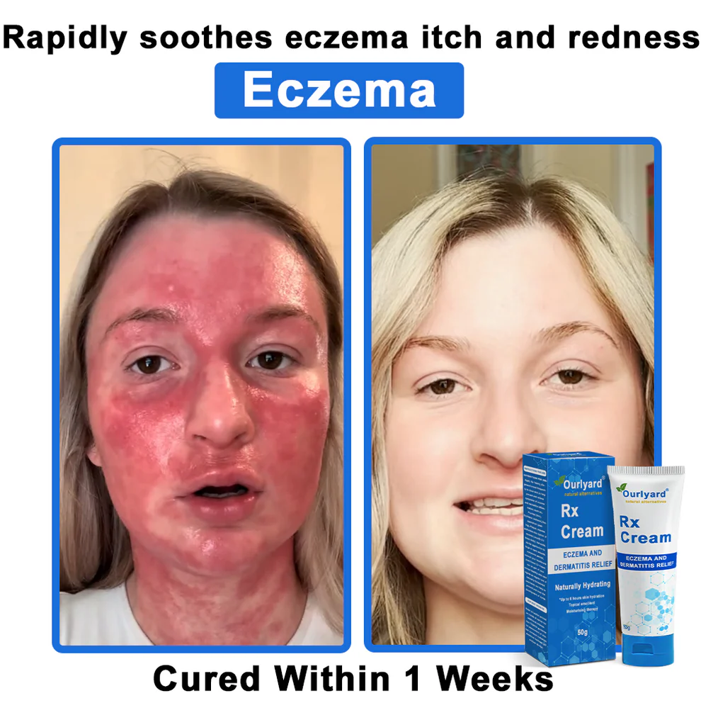 Ourlyard® OatCalm Skin Repair Cream 14 Ourlyard® OatCalm Skin Repair Cream