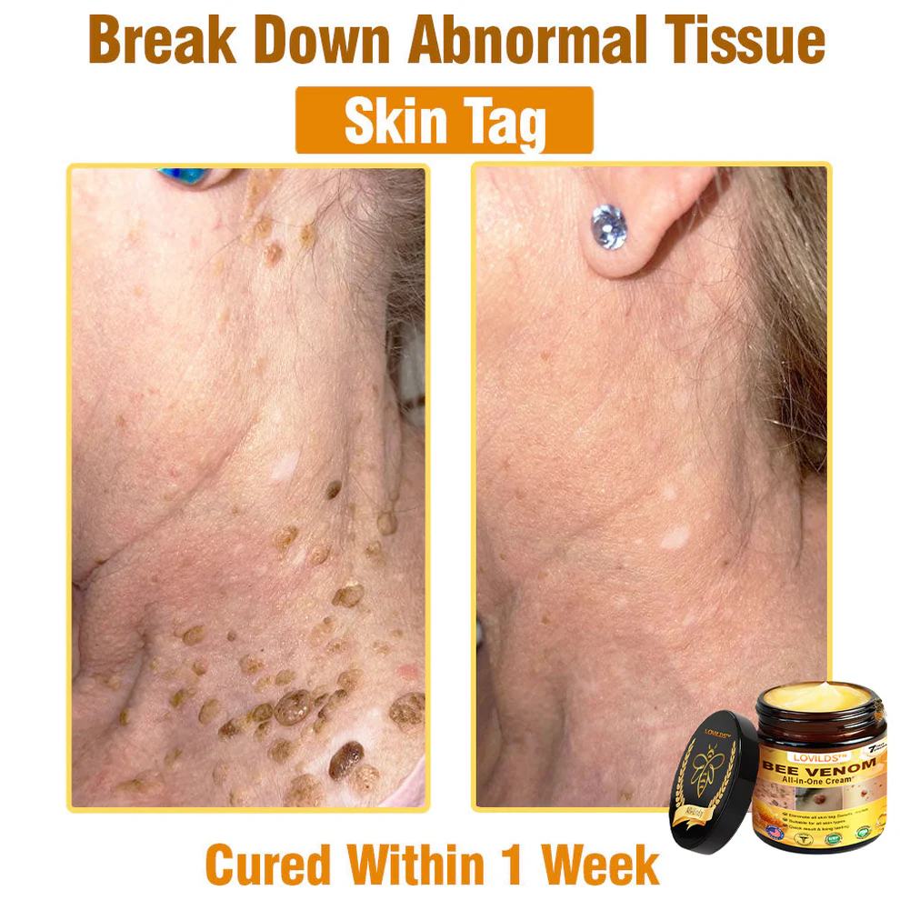 LOVILDS™ Bee Venom All-in-One Cream 2 LOVILDS™ Bee Venom All-in-One Cream