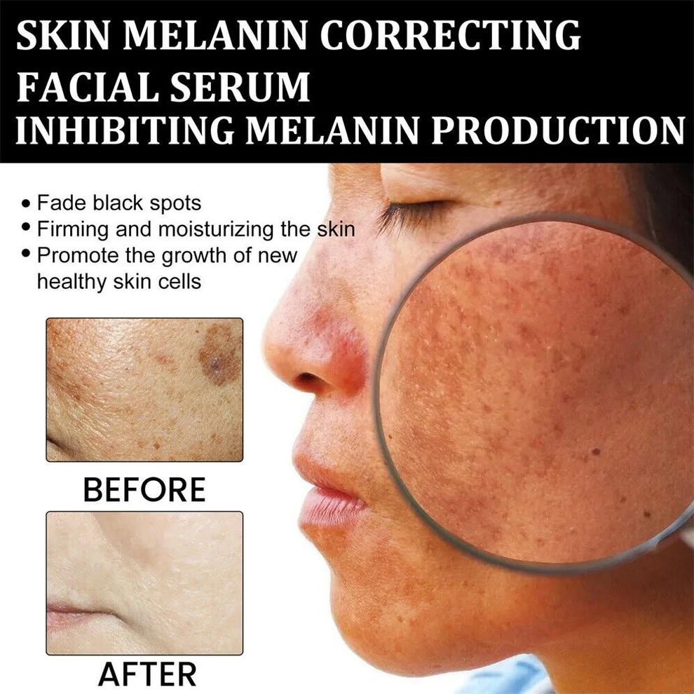 AQA™ Melanin Correcting Facial Serum 8 AQA™ Melanin Correcting Facial Serum
