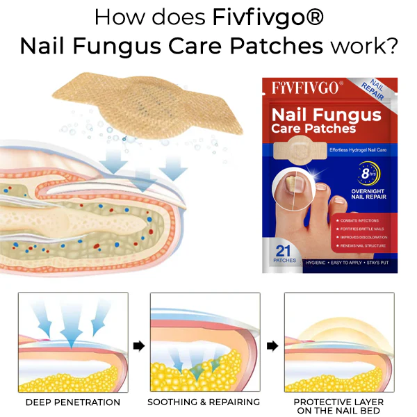 Fivfivgo® Nail Fungus Care Patches 5 Fivfivgo® Nail Fungus Care Patches