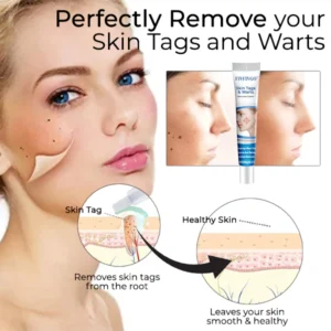 Fivfivgo™ Skin Tags & Warts Remover Cream 8 Fivfivgo™ Skin Tags & Warts Remover Cream