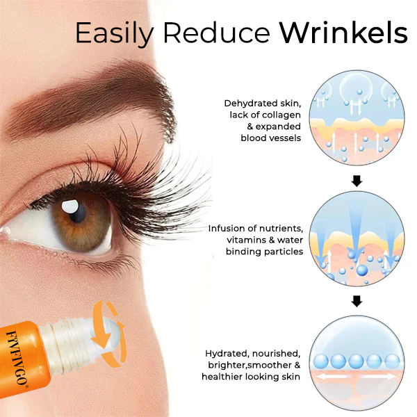 Fivfivgo® Korean VC Lutein Eye Essence Oil 7 Fivfivgo® Korean VC Lutein Eye Essence Oil