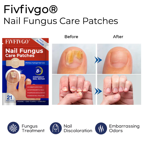 Fivfivgo® Nail Fungus Care Patches 2 Fivfivgo® Nail Fungus Care Patches