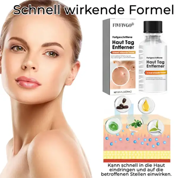 Fivfivgo® Bee Venom Tags & Moles Remover 1 Fivfivgo® Bee Venom Tags & Moles Remover