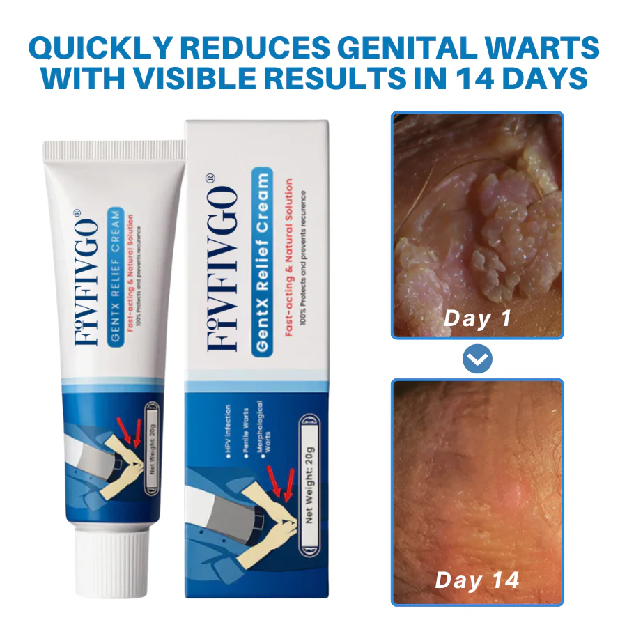 Fivfivgo® HPV Genital Warts Relief Cream 3 Fivfivgo® HPV Genital Warts Relief Cream