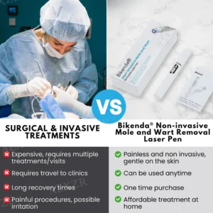 Bikenda® Non-Invasive Mole and Wart Removal Laser Pen 11 Bikenda® Non-Invasive Mole and Wart Removal Laser Pen