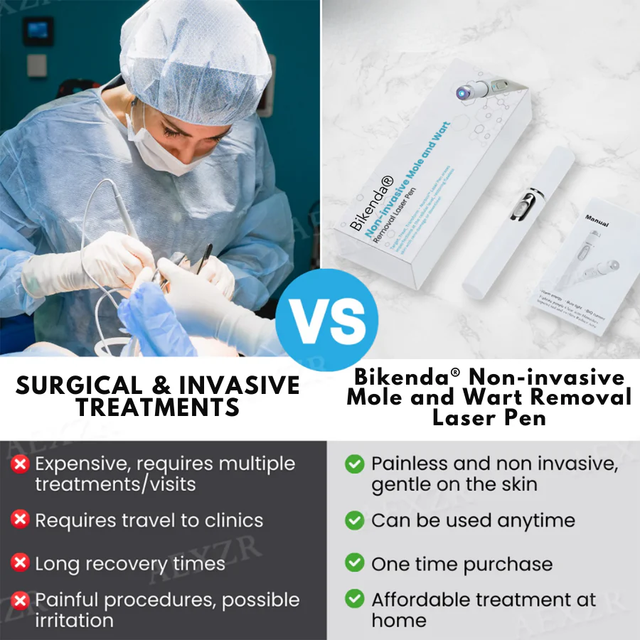 Bikenda® Non-Invasive Mole and Wart Removal Laser Pen 3 Bikenda® Non-Invasive Mole and Wart Removal Laser Pen