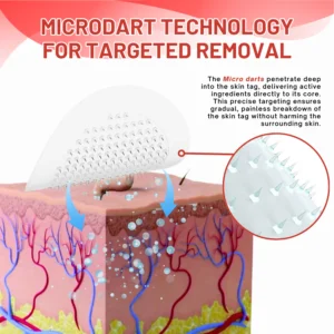 Fivfivgo® MicroDart Skin Tag Remover Patch 10 Fivfivgo® MicroDart Skin Tag Remover Patch