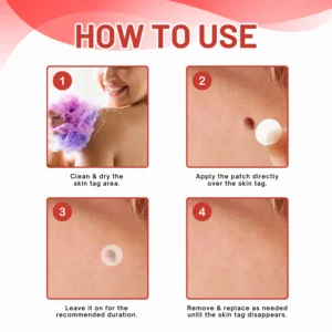 Fivfivgo® MicroDart Skin Tag Remover Patch 8 Fivfivgo® MicroDart Skin Tag Remover Patch