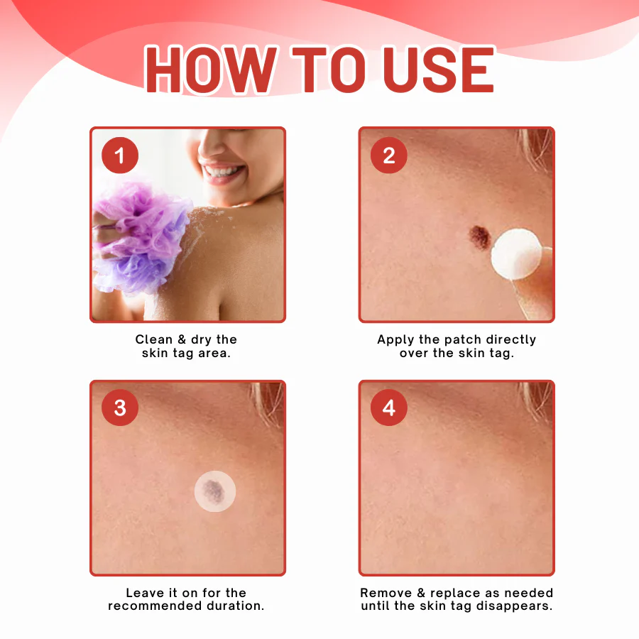 Fivfivgo® MicroDart Skin Tag Remover Patch 2 Fivfivgo® MicroDart Skin Tag Remover Patch