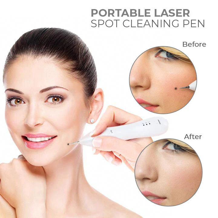 Fivfivgo™ Portable Laser Spot Cleaning Pen 5 Fivfivgo™ Portable Laser Spot Cleaning Pen