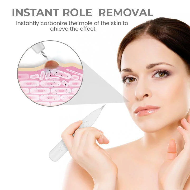 Fivfivgo™ Portable Laser Spot Cleaning Pen 4 Fivfivgo™ Portable Laser Spot Cleaning Pen